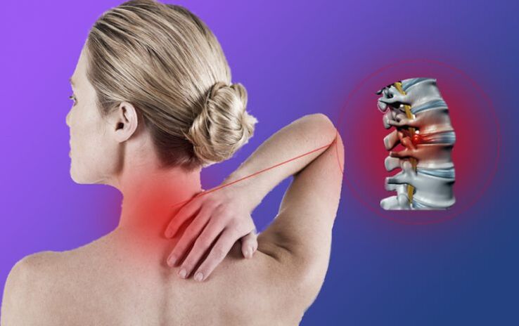 Inflamación da columna vertebral con osteocondrose cervical