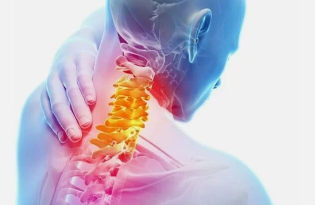 Osteocondrose da rexión do cérvix