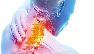 Causas da osteocondrose cervical