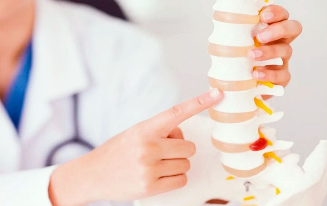 Dano á columna vertebral causado pola osteocondrose cervical
