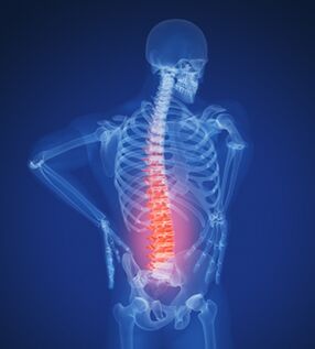 Columna lumbar e osteocondrose